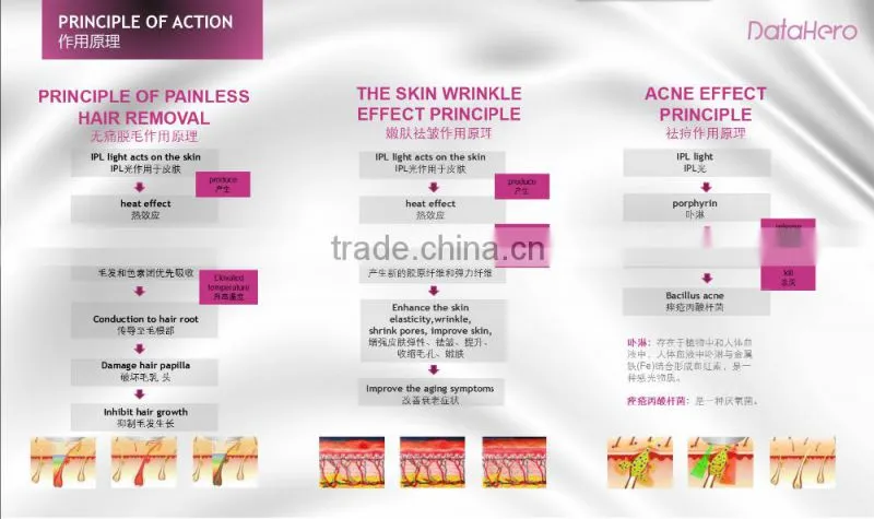 Prevents hair regrowth, for use on body only IPL(intense pulsed light) hair removal system/laser
