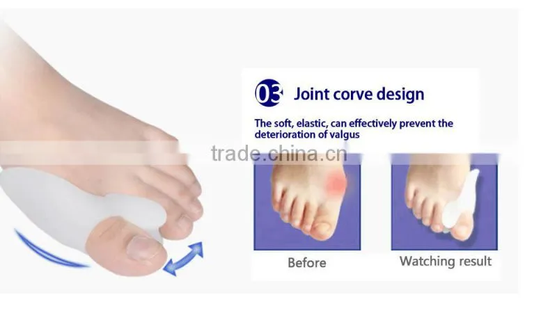 Hallux Valgus Bunion Toe Separator Valgus ,toe corrector with wholesale price