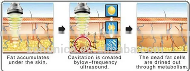 BD06C super RF vacuum with cryo Fat freezing sliming machine