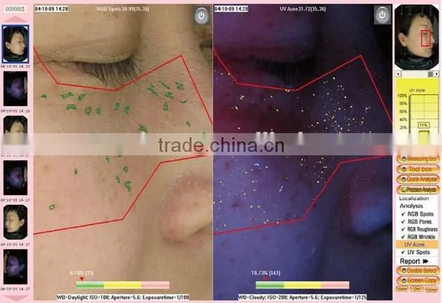 skin analyzer machine 3d skin analyzer facial skin analyzer