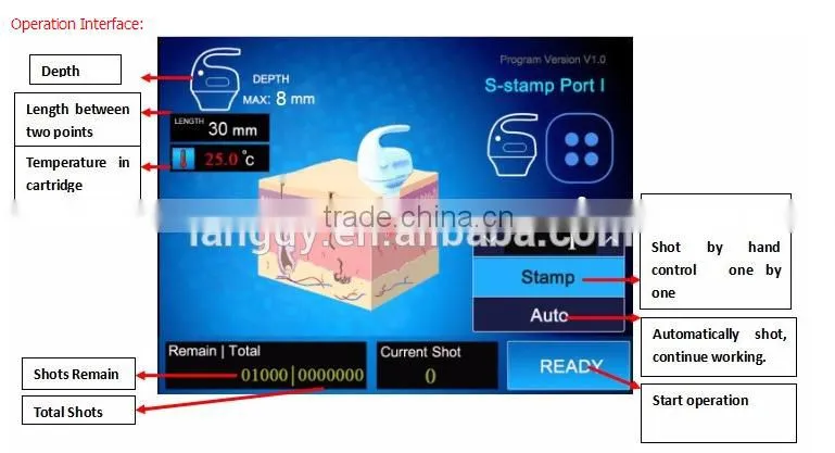 HIFU ultrasound technology resolve fat sells with training video