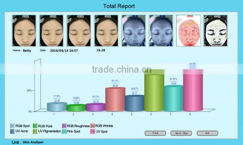 Beauty salon used fundermental device facial skin analysis maguc mirror skin analyzer