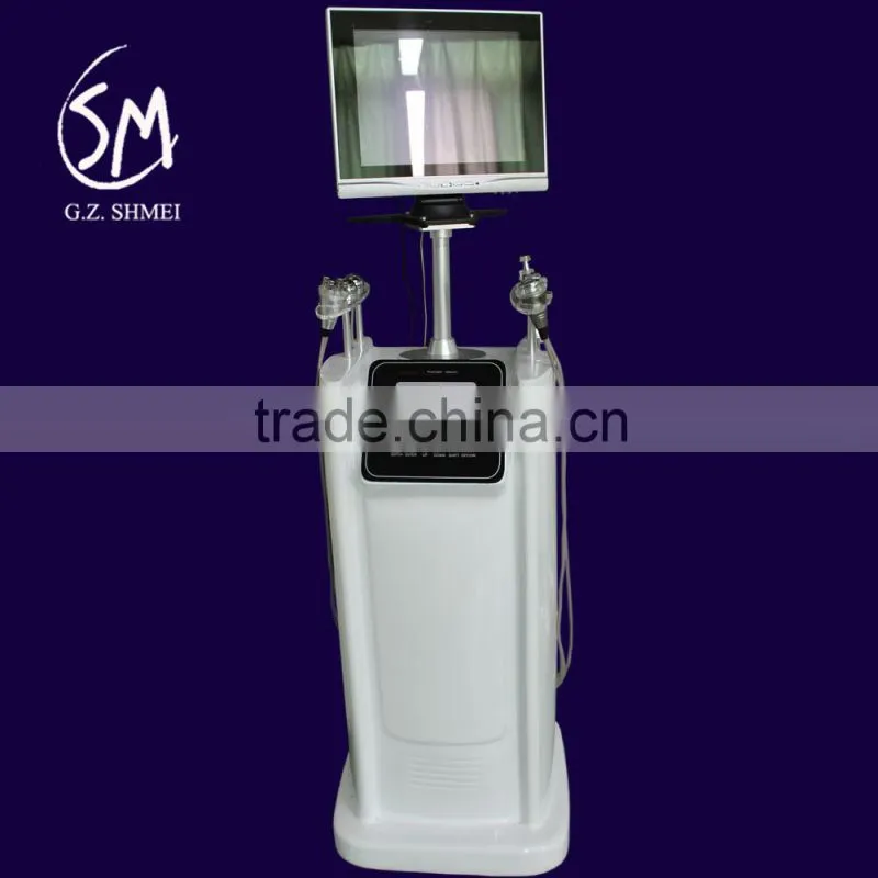 Competitive price Best-Selling e light rf beauty machine