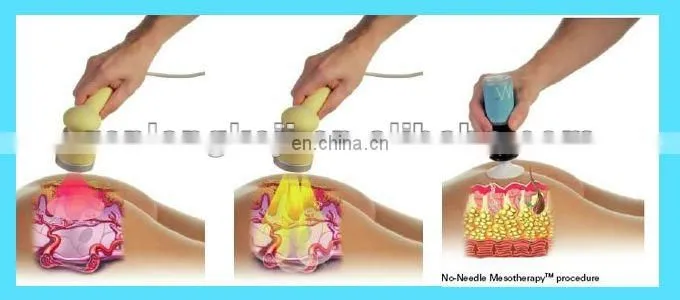 Newest portable no needle mesotherapy for freckle removal and skin whitening equipment