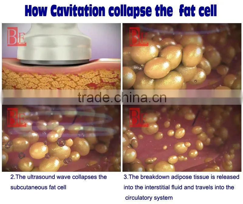 best slimming machine ultrasound cavitation slimming gel