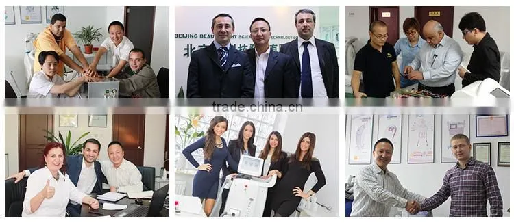 hot selling q-switched nd yag laser skin carbon rejuvenation