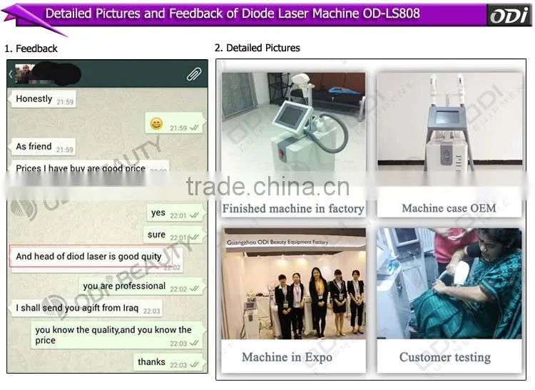 Fast result painless unhairing 808nm diode laser treatment