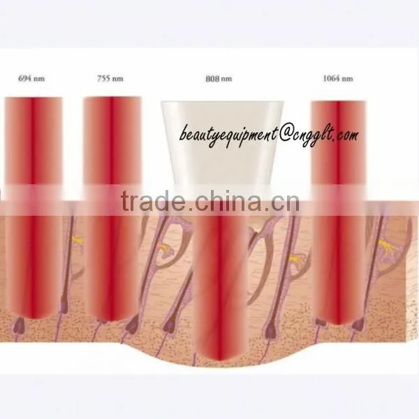 Lumenis Lightsheer Diode Laser