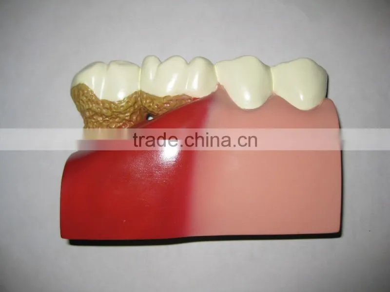 OEM anatomical cardiopulmonary model/anatomical model/teeth model/eyes model/plastic organ model