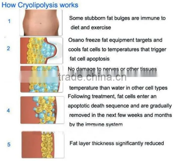 2016 NEW 2 handpiece kryolipolyse gerat / cryolipolyse kryolipolyse slimming machine / cryolipolyse machine