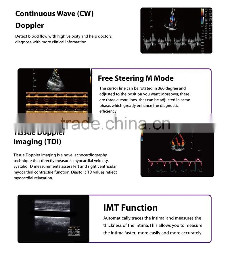 CE approved Portable Color Ultrasound Scanner with Optional 4D function( Q9)