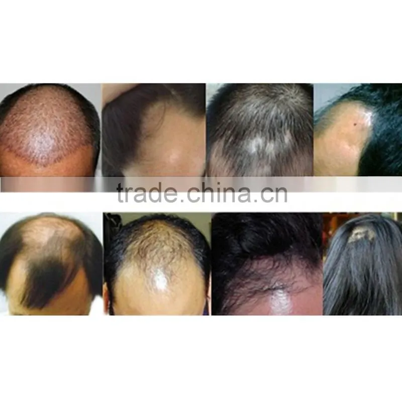 LCL2 Laser Hair Restoration Kit & Massage Loss Growth Comb Brush