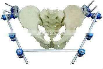 Pelvic External Fixator orthopedic external fixation