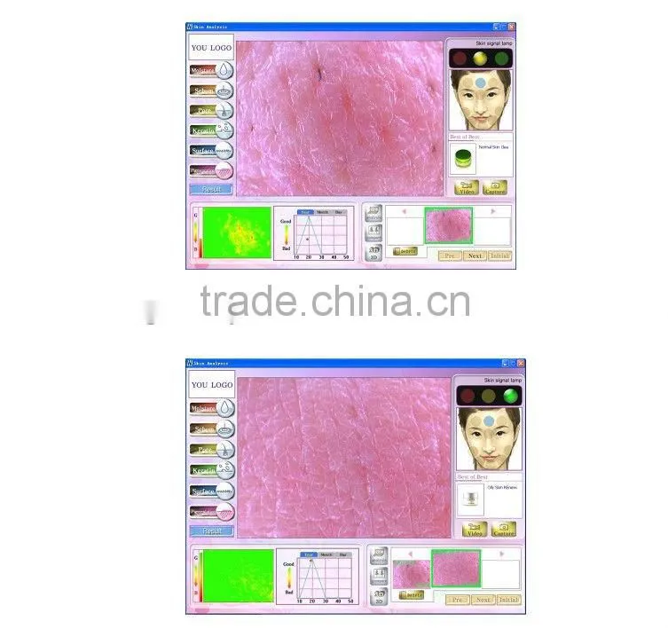 Wholesale skin analyzer machine