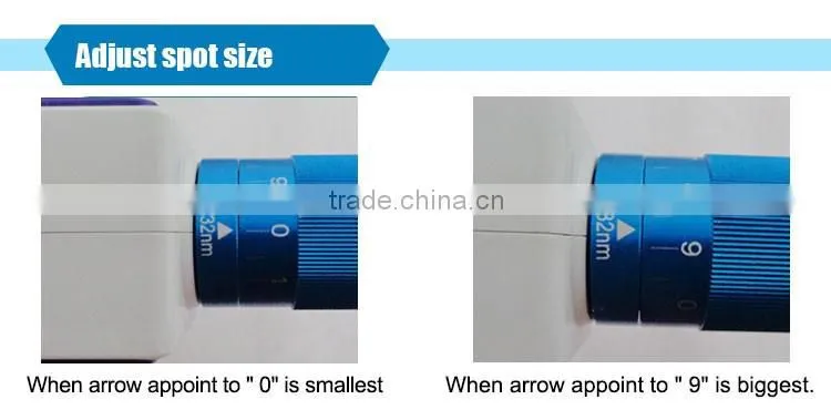 Hot selling portable machine tattoo for yag laser tattoo removal