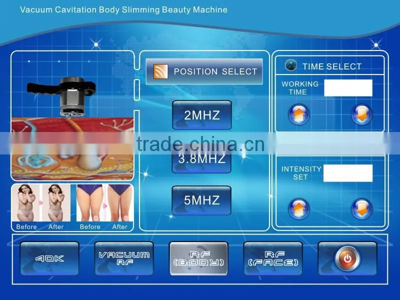 portable ultrasound cavitation RF vacuum therapy machine for body slim