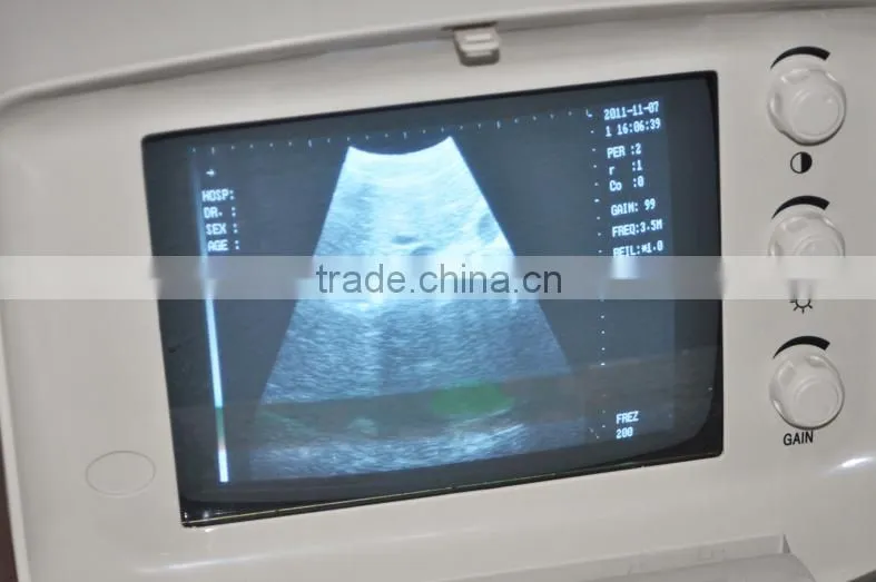 2016 CE Approved Digital Portable Style Ultrasound Machine/Scanner with cheap price