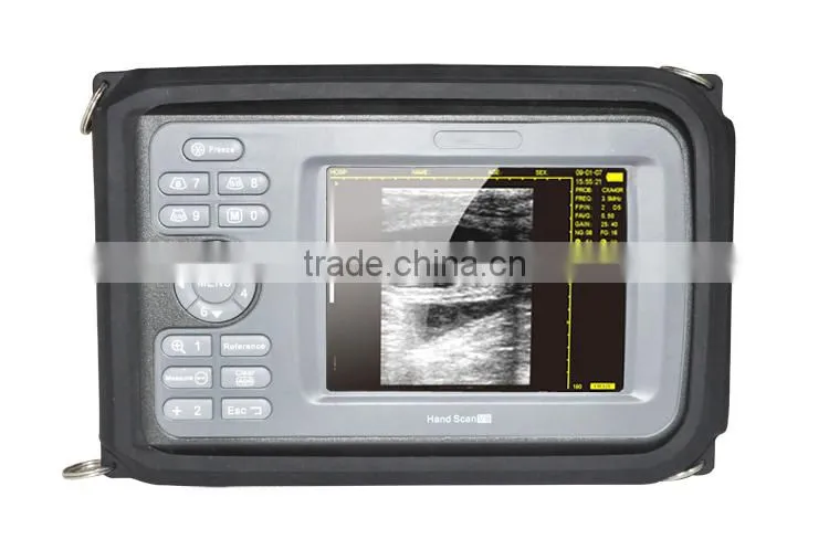 2015 new Handheld Ultrasound Scanner on sale