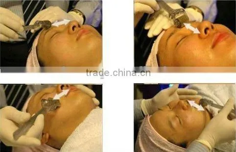 Transparent DRS derma roller,derma roller kits with 540 needles -L015