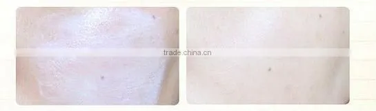 CITE 3 in 1 Sunblock whitening cream