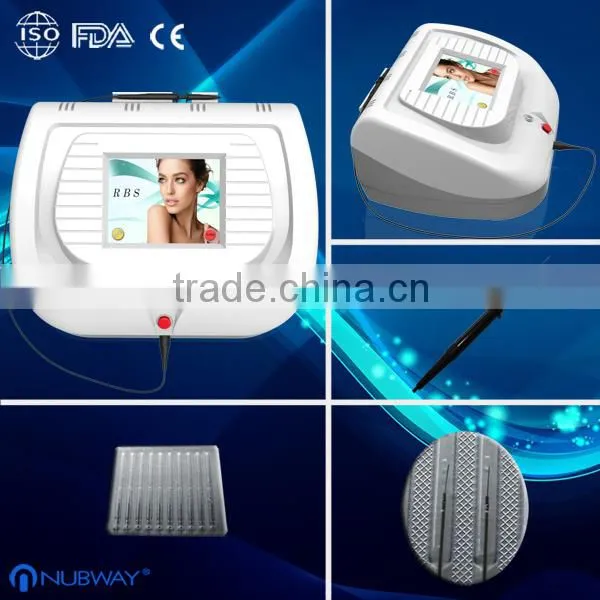 Hottest in the market!!!! super 30mhz Ultra high freqeuncy spider vein removal