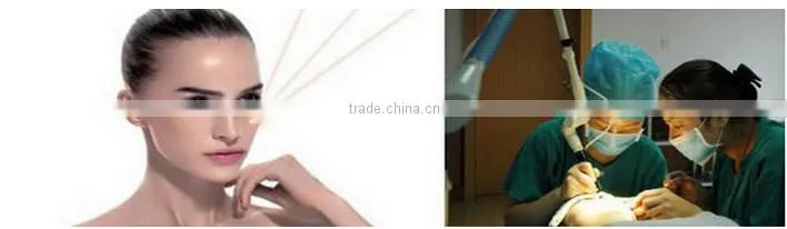 Best quality hot selling tattoo removal machine 1064nm&532nm q switched nd yag laser