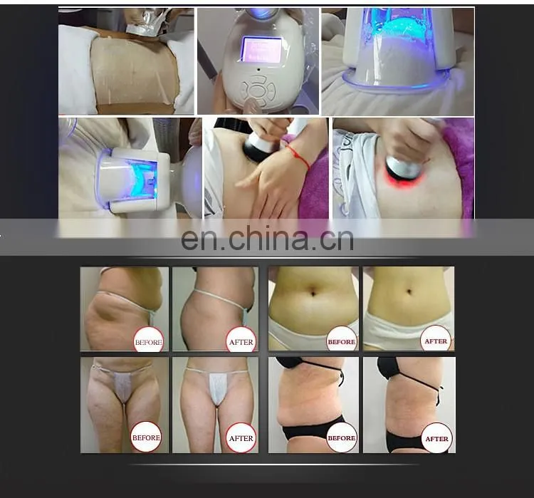 China Supplier! Cryotherapy machine whole body for sale/Fat Freezing machine home device