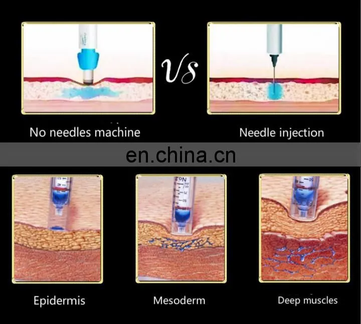 Handheld skin rejuvenation needleless injection device / needle free injection machine