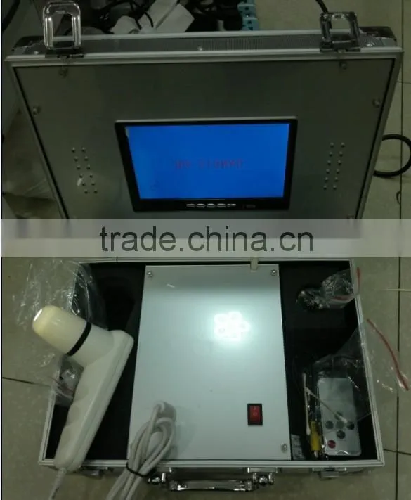 the best Guangzhou 12inchLCD freeze-frame skin and hair analyser with factory price