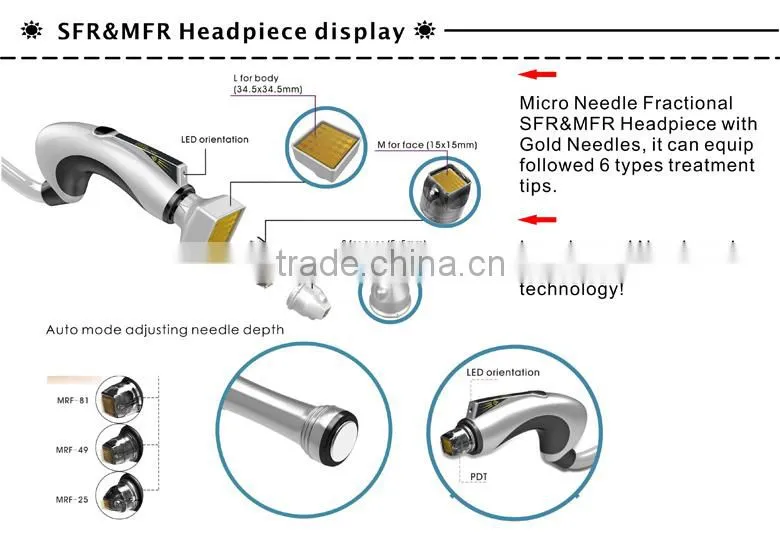 Newest Radiofrequency Microneedle Wrinkle Removal