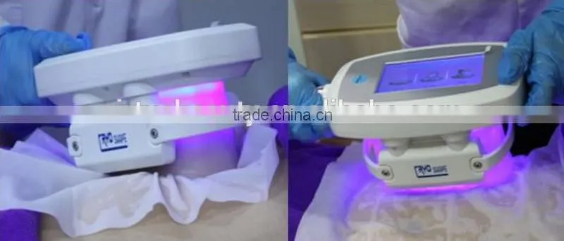 portable weight loss criolipolysis fat freezing beauty machine price