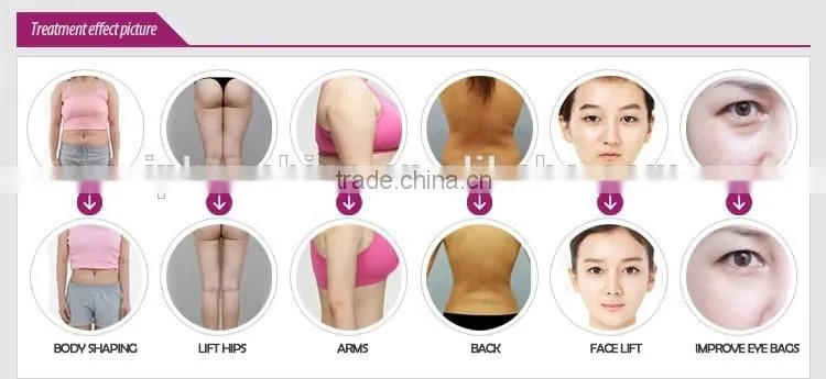 Popular fast slimming machine for weight loss