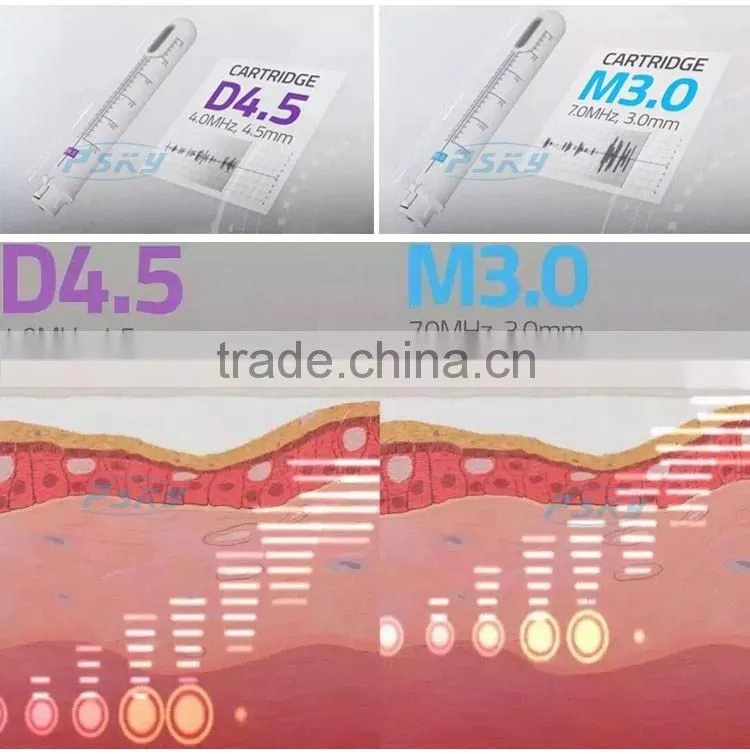 10000 shots woman painless vaginal rejuvenation HIFU machine for sale