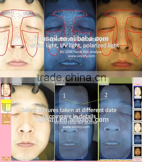 Magic Mirror Skin Analyzer