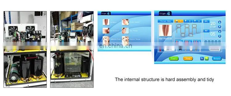 Salon use IPL hair removal elight opt depilador skin therapy machine painless