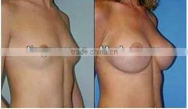 breast enhancement products breast nipple enhancer tm-505