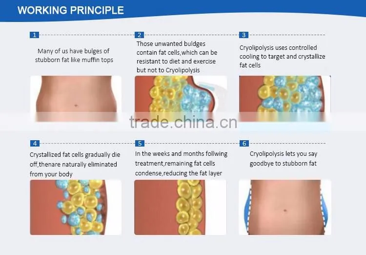 Latest cryo + cavitation + RF technologies water cooling system comfortable body slimming shaper