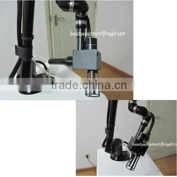 High qaulity glass co2 laser skin tag removal machine