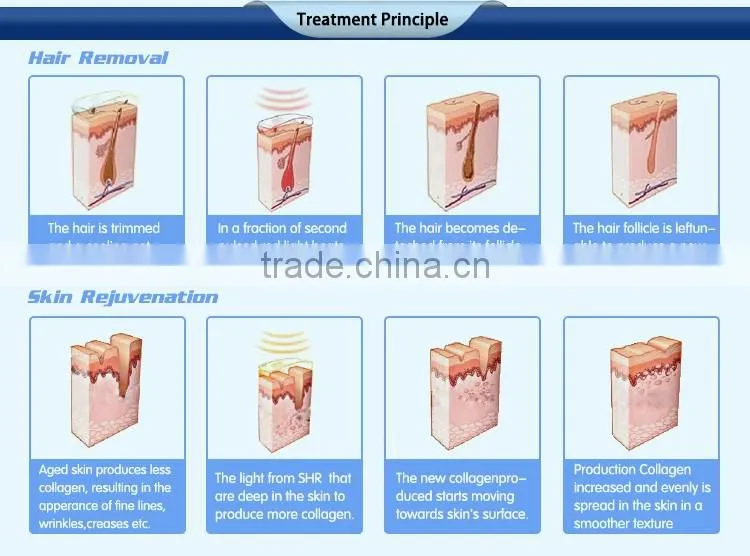 3 in 1 professional multifunctional shr ipl elight hair removal beauty machine anti aging women skin rejuvenation