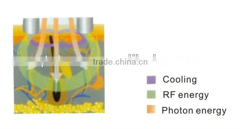 Chinese Med CE& ISO approved beauty machine e light