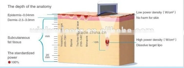 cavitation hifu slim machine / High Quality Hifu