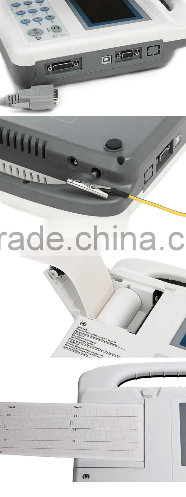 Beijing High resolution thermal printing system 3.8 inch LCD Three channel digital ECG machine for sale