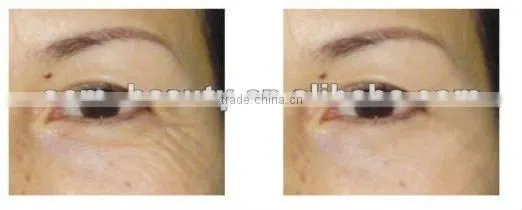 2012 popular Mini skin roller derma care products L007