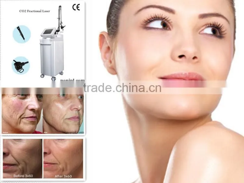 Acne Treatment Skin Rejuvenation Skin Tightening er yag laser scar CO2 laser