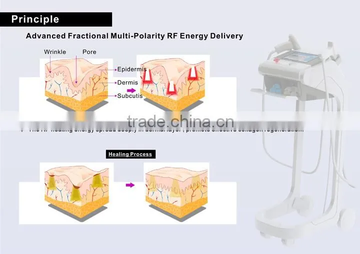 Professional Rf Fractional Micro Needle/ Microneedle Skin Care System