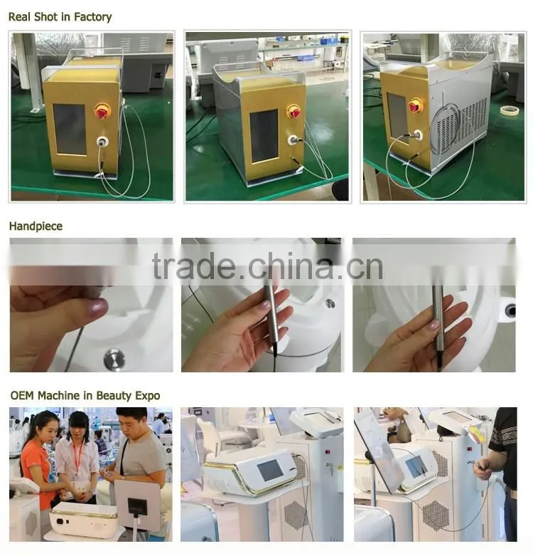 Technology 2016 varicose vein removal 980 vascular therapy machine