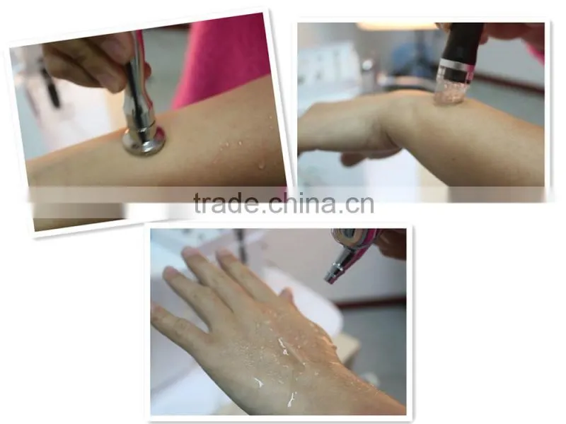 NL-SPA400 Professional Diamond Microdermabrasion Ultrasonic Skin Scrubber Cleansing Face Beauty SPA machine