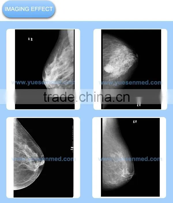 high frequency fixed or rotating anode cheapest mammography x ray price