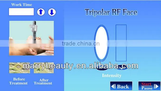 shopping online websites vacuum cavitation rf machine