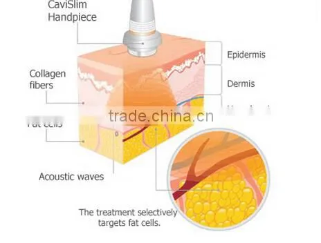 oem home use32khz cavitation 3mhz rf slimming machine for skin tightening